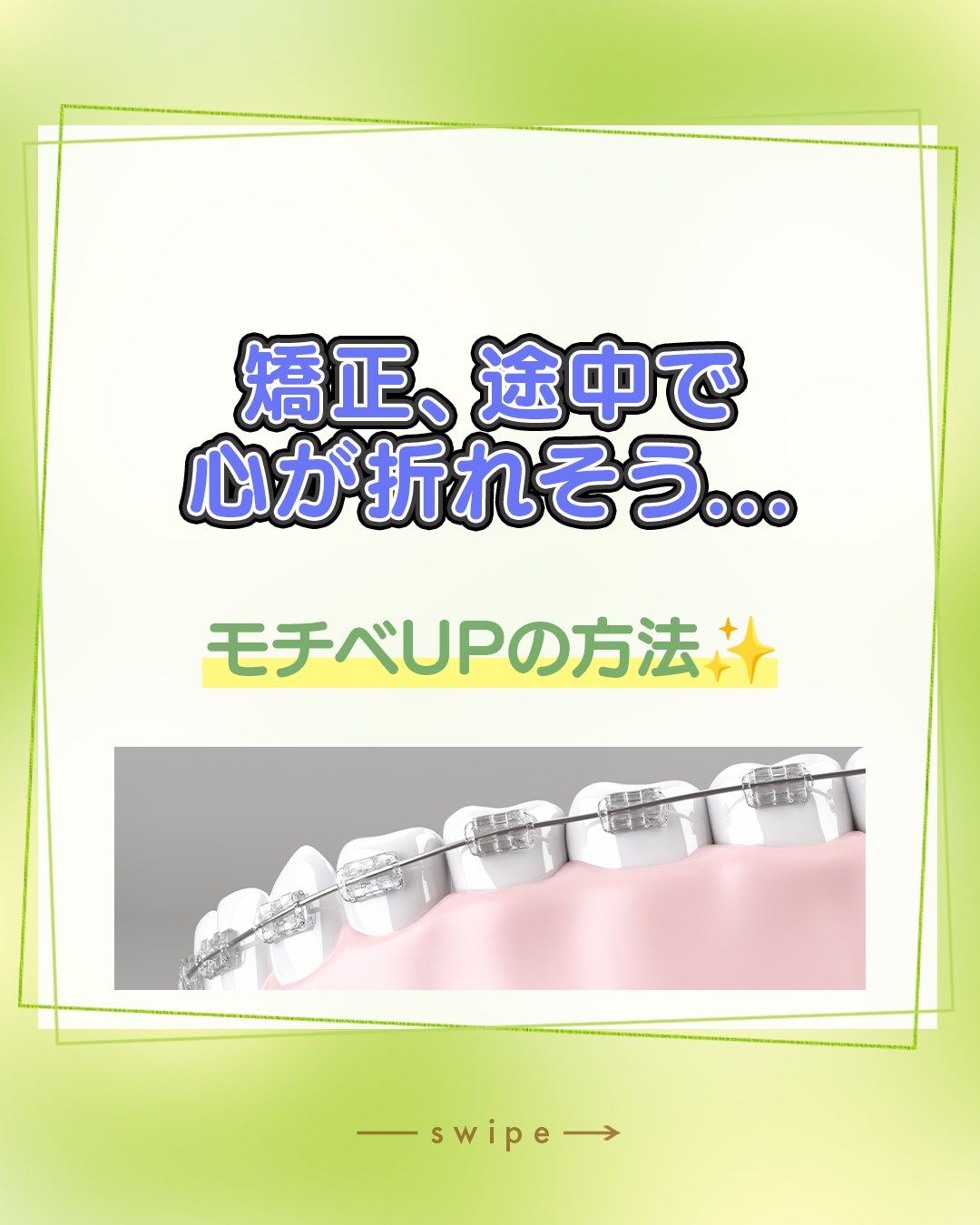 「歯列矯正、長丁場で途中で心が折れそう…泣」
