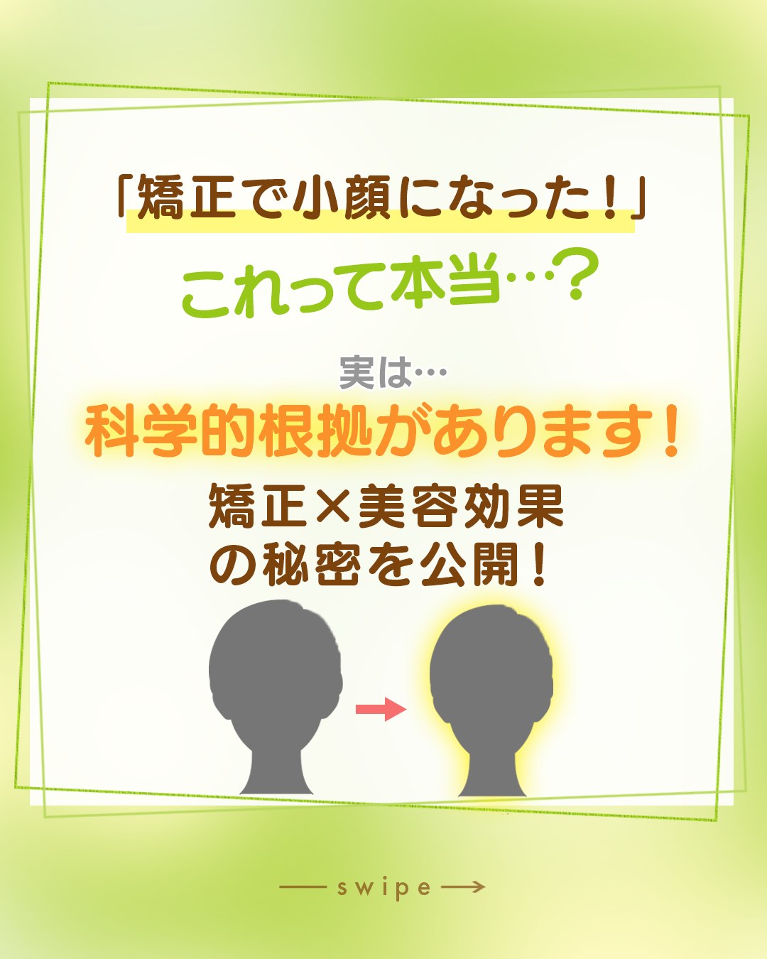 「矯正したら小顔になった気がする！」