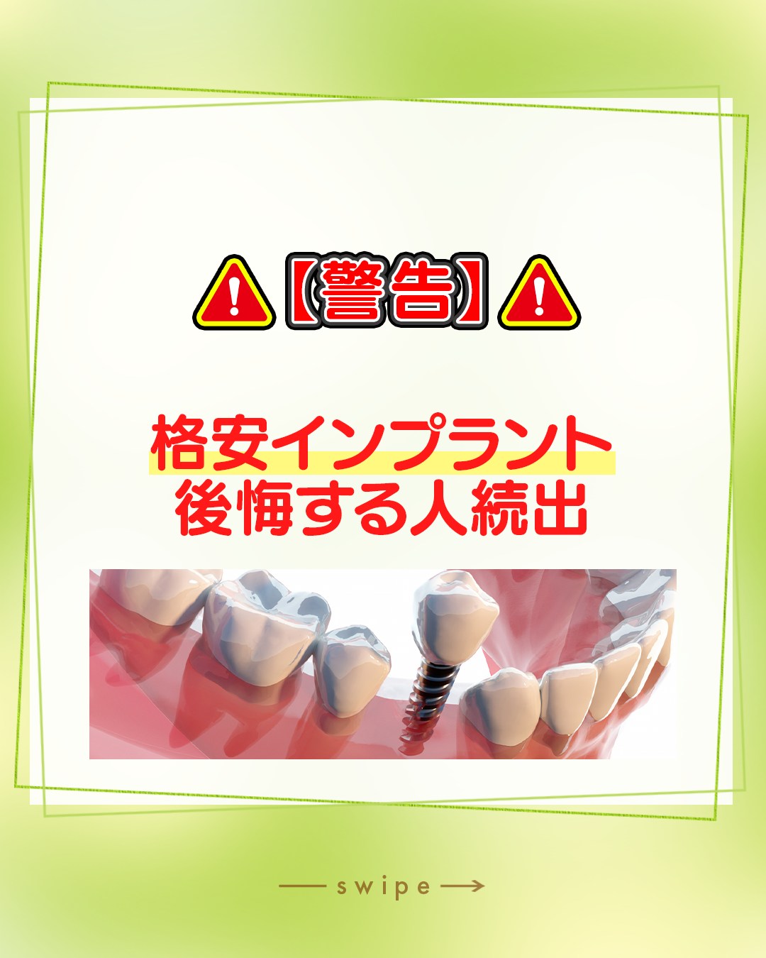 ⚠️【警告】格安インプラントで後悔する人が続出しています⚠️